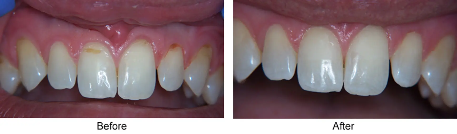 6881d9ac1684b3ebaffdeed3